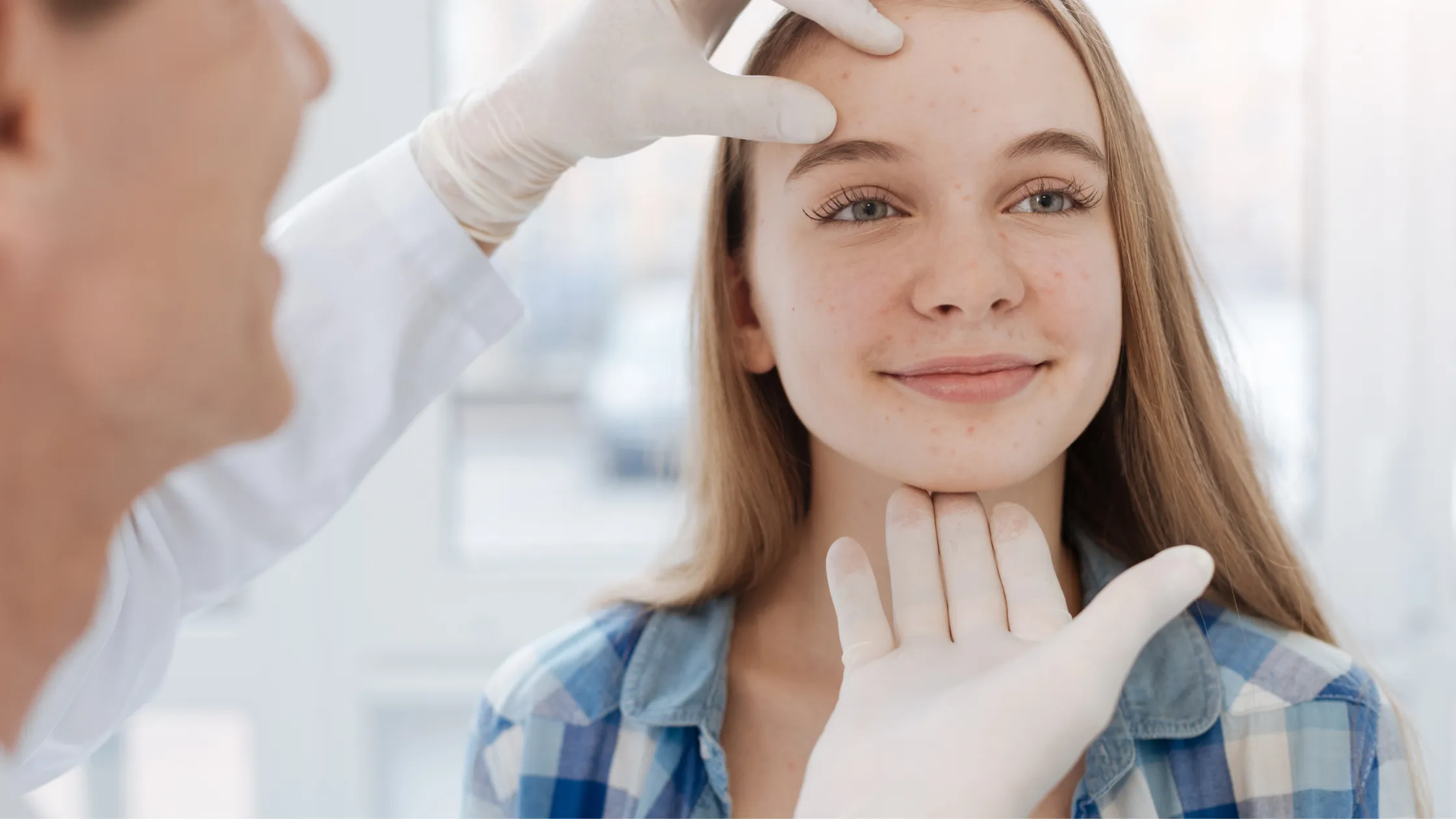 Behandeling-acne.png